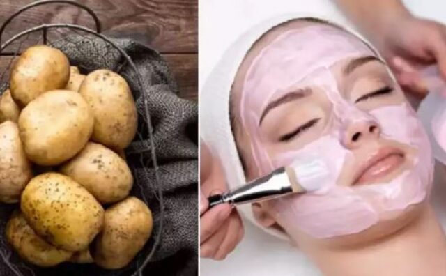 Power of Potatoes: A Guide to Fading Freckles and Spots Naturally